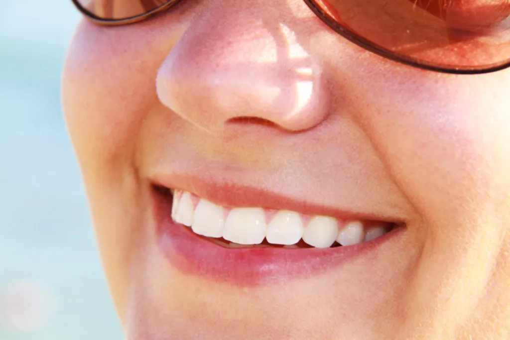 Blanqueamiento dental