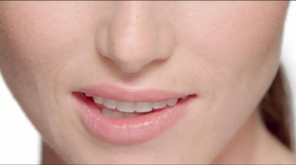 Diseño de sonrisa