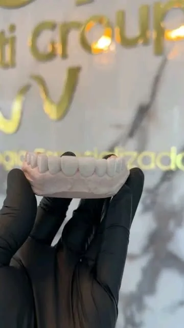 Prótesis dentales